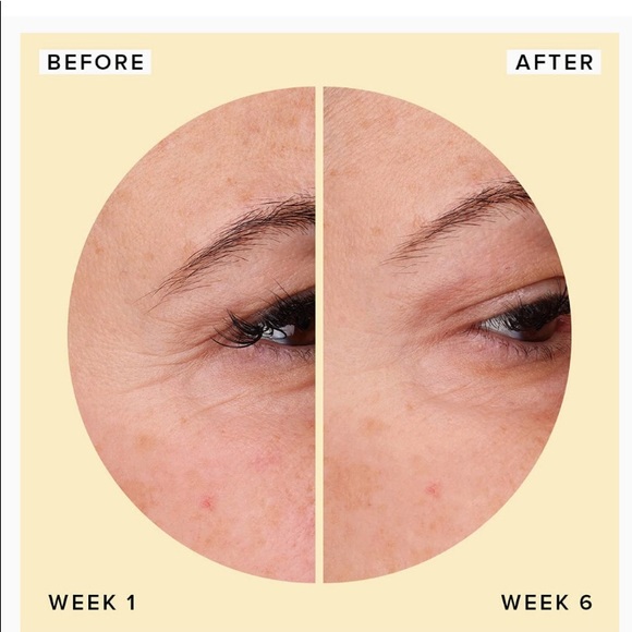 Hyaluronic Acid Serum for Face - Anti Aging Serum - Picture 3 of 6